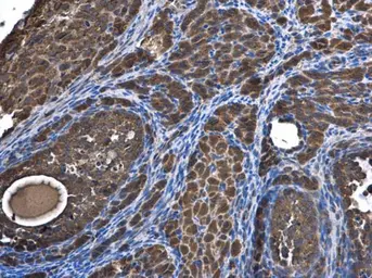Anti-SAR1B antibody used in IHC (Paraffin sections) (IHC-P). GTX109170