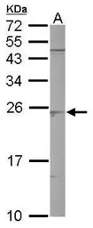 Anti-SAR1B antibody used in Western Blot (WB). GTX109170