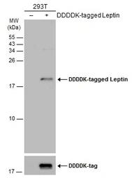 Anti-Leptin antibody used in Western Blot (WB). GTX109204