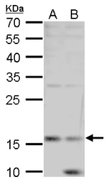 Anti-Leptin antibody used in Western Blot (WB). GTX109204