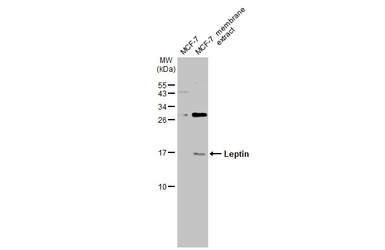 Anti-Leptin antibody used in Western Blot (WB). GTX109204