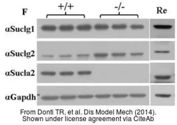 Anti-SUCLG1 antibody used in Western Blot (WB). GTX109215