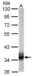 Anti-SUCLG1 antibody used in Western Blot (WB). GTX109215
