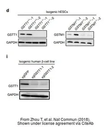 Anti-GSTT1 antibody used in Western Blot (WB). GTX109250