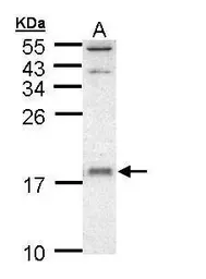 Anti-UBE2D1 antibody used in Western Blot (WB). GTX109257