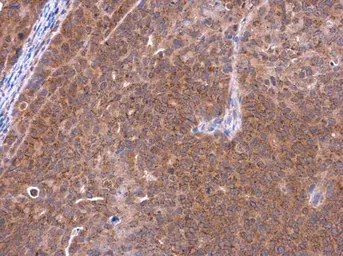Anti-Telethonin antibody [N1C3] used in IHC (Paraffin sections) (IHC-P). GTX109265