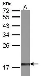 Anti-DUSP26 antibody [N1C1] used in Western Blot (WB). GTX109283