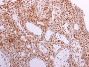 Anti-MST1 antibody used in IHC (Paraffin sections) (IHC-P). GTX109294