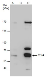 Anti-MST1 antibody used in Immunoprecipitation (IP). GTX109294