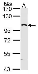 Anti-KHS antibody [N3C1], Internal used in Western Blot (WB). GTX109297
