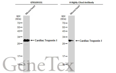 Anti-Cardiac Troponin I antibody [N1C3] used in Western Blot (WB). GTX109331