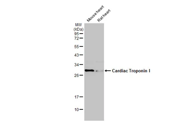 Anti-Cardiac Troponin I antibody [N1C3] used in Western Blot (WB). GTX109331