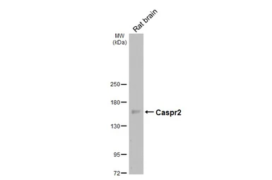 Anti-Caspr2 antibody [N2N3] used in Western Blot (WB). GTX109389