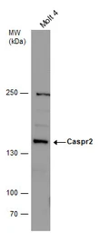 Anti-Caspr2 antibody [N2N3] used in Western Blot (WB). GTX109389