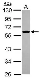 Anti-FYN antibody [N1C2] used in Western Blot (WB). GTX109428