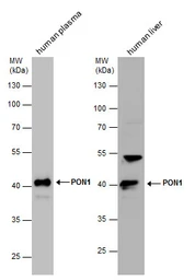 Anti-PON1 antibody used in Western Blot (WB). GTX109561