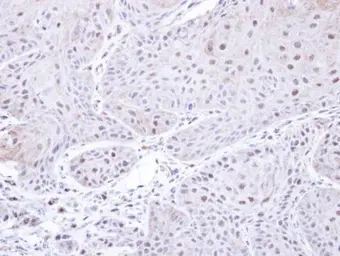 Anti-PSMC3 antibody [N1C2] used in IHC (Paraffin sections) (IHC-P). GTX109605