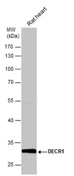 Anti-DECR1 antibody [N1C3] used in Western Blot (WB). GTX109608
