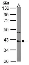 Anti-p53R2 antibody [N1C3] used in Western Blot (WB). GTX109620