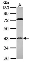 Anti-p53R2 antibody [N1C3] used in Western Blot (WB). GTX109620