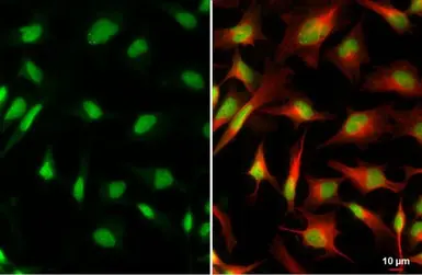Anti-XRCC4 antibody used in Immunocytochemistry/ Immunofluorescence (ICC/IF). GTX109632