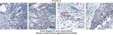 Anti-PGP9.5 antibody used in IHC (Paraffin sections) (IHC-P). GTX109637