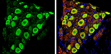 Anti-PGP9.5 antibody used in IHC (Paraffin sections) (IHC-P). GTX109637