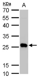 Anti-PGP9.5 antibody used in Western Blot (WB). GTX109637