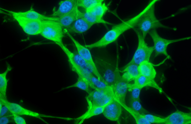 Anti-PGP9.5 antibody used in Immunocytochemistry/ Immunofluorescence (ICC/IF). GTX109637
