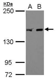 Anti-EEA1 antibody [C3], C-term used in Western Blot (WB). GTX109638