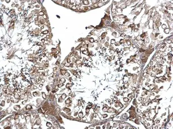 Anti-EEA1 antibody [C3], C-term used in IHC (Paraffin sections) (IHC-P). GTX109638