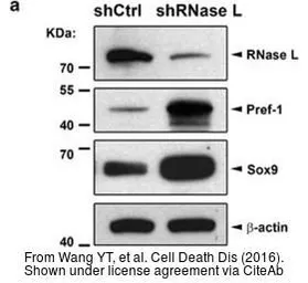 Anti-beta Actin antibody used in Western Blot (WB). GTX109639