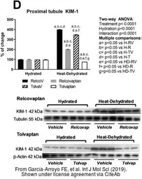 Anti-beta Actin antibody used in Western Blot (WB). GTX109639
