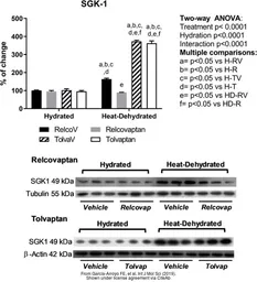 Anti-beta Actin antibody used in Western Blot (WB). GTX109639