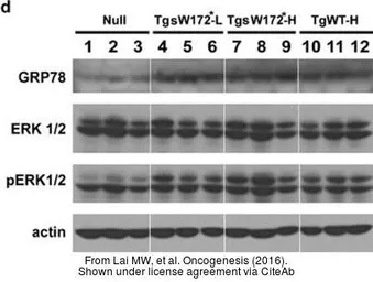 Anti-beta Actin antibody used in Western Blot (WB). GTX109639