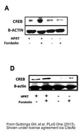 Anti-beta Actin antibody used in Western Blot (WB). GTX109639