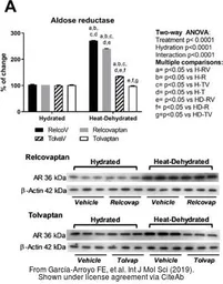 Anti-beta Actin antibody used in Western Blot (WB). GTX109639