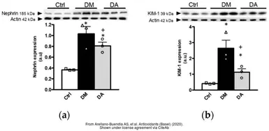Anti-beta Actin antibody used in Western Blot (WB). GTX109639