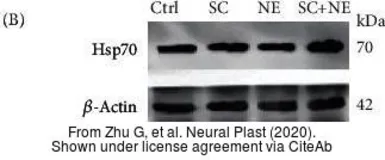 Anti-beta Actin antibody used in Western Blot (WB). GTX109639