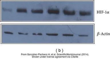 Anti-beta Actin antibody used in Western Blot (WB). GTX109639