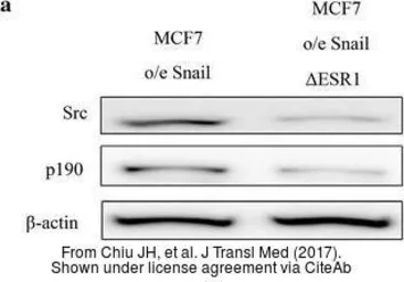 Anti-beta Actin antibody used in Western Blot (WB). GTX109639