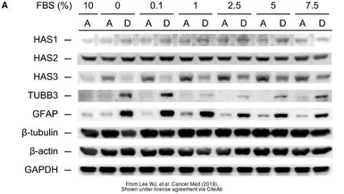 Anti-beta Actin antibody used in Western Blot (WB). GTX109639