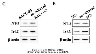 Anti-beta Actin antibody used in Western Blot (WB). GTX109639