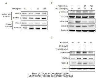 Anti-beta Actin antibody used in Western Blot (WB). GTX109639