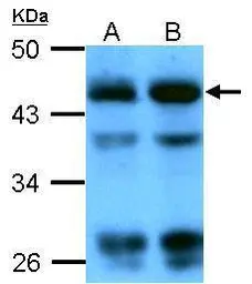 Anti-beta Actin antibody used in Western Blot (WB). GTX109639