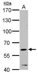Anti-HDAC2 antibody used in Western Blot (WB). GTX109642