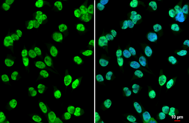Anti-HDAC2 antibody used in Immunocytochemistry/ Immunofluorescence (ICC/IF). GTX109642