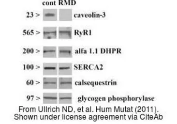 Anti-Caveolin 3 antibody [N1N2], N-term used in Western Blot (WB). GTX109650
