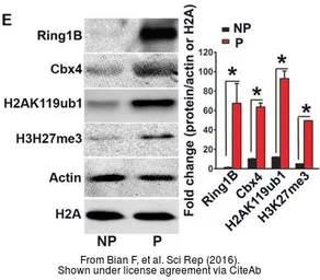 Anti-CBX4 antibody [C3], C-term used in Western Blot (WB). GTX109662