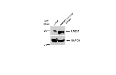 Anti-RAB5A antibody used in Western Blot (WB). GTX109665